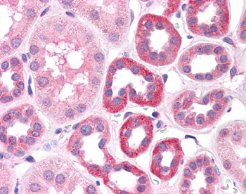 HNF1A Rabbit Polyclonal Antibody