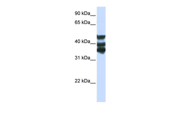 HGD Rabbit Polyclonal Antibody