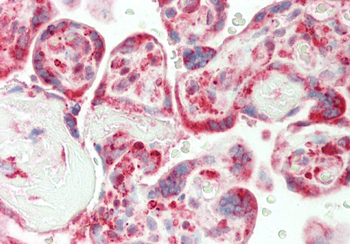 CRIP1 Rabbit Polyclonal Antibody