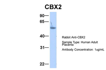 CBX2 Rabbit Polyclonal Antibody