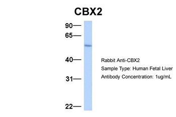 CBX2 Rabbit Polyclonal Antibody