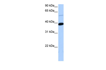 ZNF562 Rabbit Polyclonal Antibody