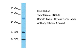 ZNF562 Rabbit Polyclonal Antibody