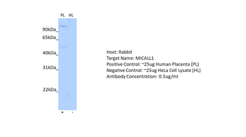 MICALL1 Rabbit Polyclonal Antibody