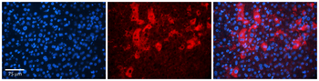 ABAT Rabbit Polyclonal Antibody