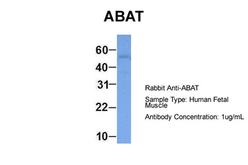 ABAT Rabbit Polyclonal Antibody