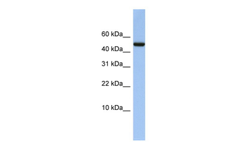 ABAT Rabbit Polyclonal Antibody