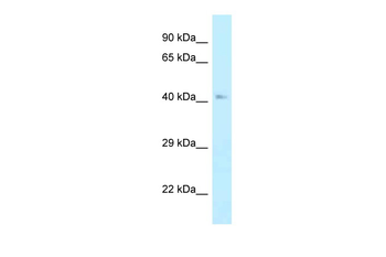 Ahcy Rabbit Polyclonal Antibody