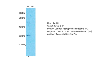 DCK Rabbit Polyclonal Antibody