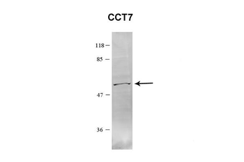 Cct7 Rabbit Polyclonal Antibody