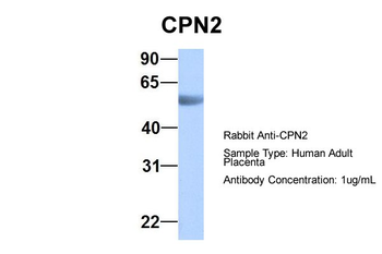 CPN2 Rabbit Polyclonal Antibody