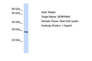 SERPINA3 Rabbit Polyclonal Antibody