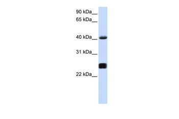 SERPINA3 Rabbit Polyclonal Antibody