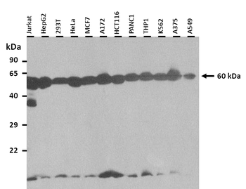 CYP11A1 Rabbit Polyclonal Antibody