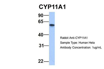 CYP11A1 Rabbit Polyclonal Antibody