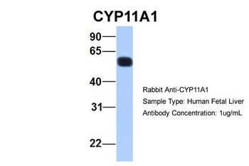 CYP11A1 Rabbit Polyclonal Antibody