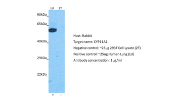 CYP11A1 Rabbit Polyclonal Antibody