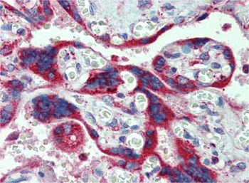 CYP11A1 Rabbit Polyclonal Antibody