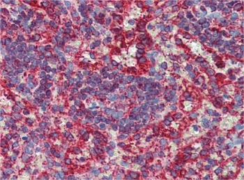 CYP11A1 Rabbit Polyclonal Antibody