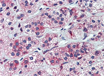 CYP11A1 Rabbit Polyclonal Antibody