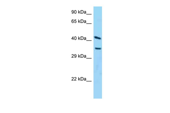 ADPRH Rabbit Polyclonal Antibody