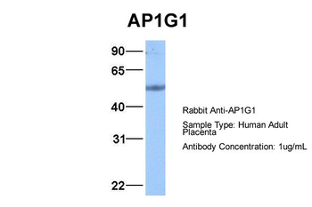 AP1G1 Rabbit Polyclonal Antibody