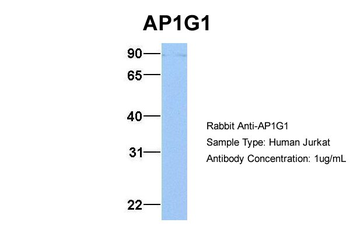 AP1G1 Rabbit Polyclonal Antibody