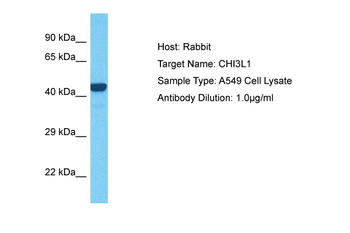 CHI3L1 Rabbit Polyclonal Antibody
