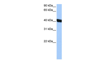 CHI3L1 Rabbit Polyclonal Antibody