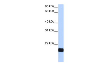 CTF1 Rabbit Polyclonal Antibody