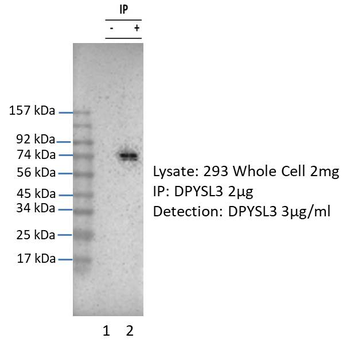 DPYSL3 Rabbit Polyclonal Antibody