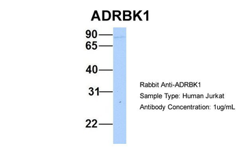 GRK2 Rabbit Polyclonal Antibody
