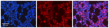 GRK2 Rabbit Polyclonal Antibody