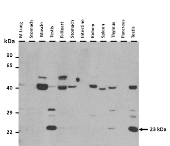 Cdo1 Rabbit Polyclonal Antibody