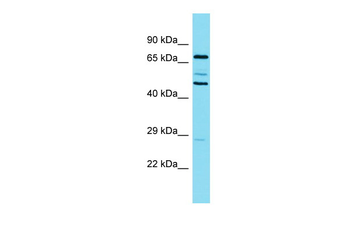 CTTN Rabbit Polyclonal Antibody