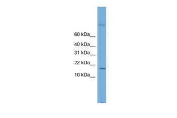 CST8 Rabbit Polyclonal Antibody
