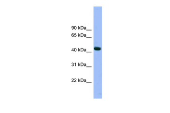 ACTR3 Rabbit Polyclonal Antibody