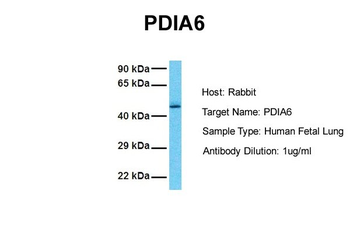 PDIA6 Rabbit Polyclonal Antibody