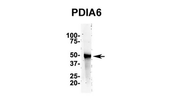 PDIA6 Rabbit Polyclonal Antibody