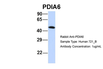 PDIA6 Rabbit Polyclonal Antibody