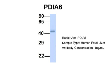 PDIA6 Rabbit Polyclonal Antibody
