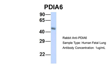 PDIA6 Rabbit Polyclonal Antibody