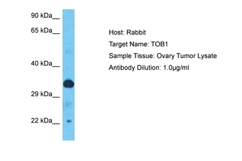 TOB1 Rabbit Polyclonal Antibody