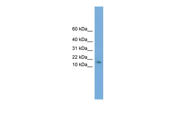RIDA Rabbit Polyclonal Antibody
