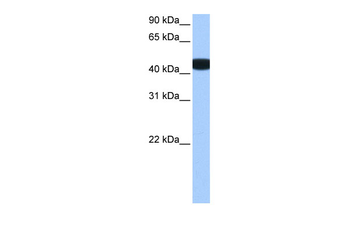 BCKDK Rabbit Polyclonal Antibody