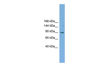 TACC3 Rabbit Polyclonal Antibody
