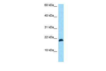 HBXIP Rabbit Polyclonal Antibody