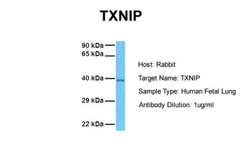TXNIP Rabbit Polyclonal Antibody