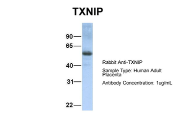 TXNIP Rabbit Polyclonal Antibody