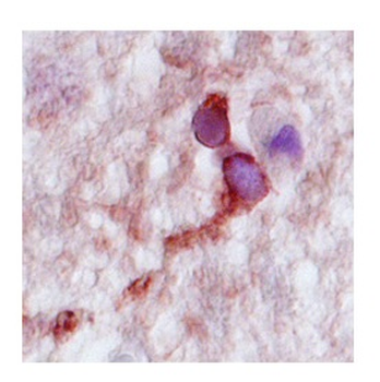 CPLX2 Rabbit Polyclonal Antibody
